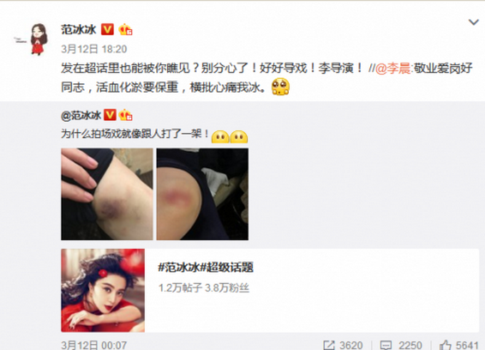 范冰冰穿睡衣遛狗照曝光 網(wǎng)友-長(zhǎng)得好看穿麻袋也依然很美！