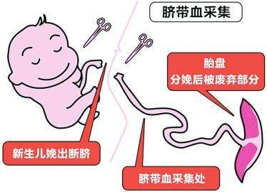 北京3歲男童移植自體臍帶血救命