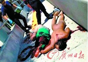 啃臉血案震驚全美 食臉惡魔疑因吸食毒品后發狂