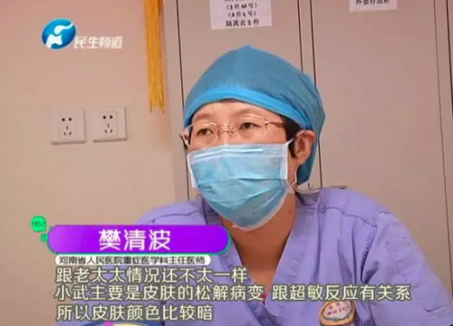 小伙患怪病 感冒吃藥后全身變紫