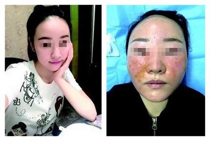 花3萬美容變毀容 盤點整容失敗案例女星變女丑
