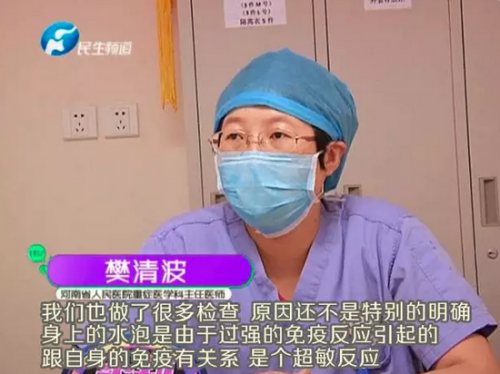 小伙患怪病 感冒吃藥后全身變紫