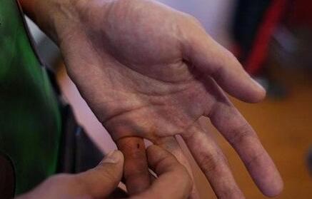 主持人大左錄制《鮮廚當道》意外中毒 大左為什么會中毒